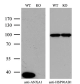 Anti-Annexin A1 antibody [3A8] used in Western Blot (WB). GTX84886