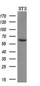 Anti-alpha amylase 2A (pancreatic) antibody [6D4] used in Western Blot (WB). GTX84887