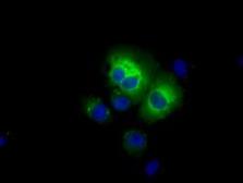 Anti-ALDH3A1 antibody [1B6] used in Immunocytochemistry/ Immunofluorescence (ICC/IF). GTX84889