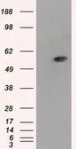 Anti-ALDH3A1 antibody [1B6] used in Western Blot (WB). GTX84889