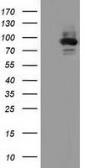 Anti-ALDH1L1 antibody [6A10] used in Western Blot (WB). GTX84891