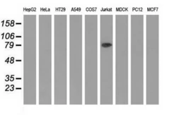 Anti-ALDH1L1 antibody [7B7] used in Western Blot (WB). GTX84895