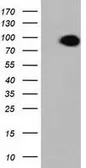 Anti-ALDH1L1 antibody [1H6] used in Western Blot (WB). GTX84897