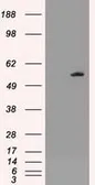 Anti-AKT3 antibody [9B2] used in Western Blot (WB). GTX84906