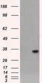 Anti-AKR1A1 antibody [4G2] used in Western Blot (WB). GTX84912