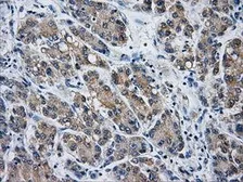 Anti-AKR1A1 antibody [9F1] used in IHC (Paraffin sections) (IHC-P). GTX84918