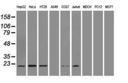Anti-Adenylate kinase 1 antibody [19D1] used in Western Blot (WB). GTX84939