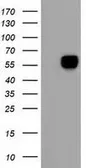 Anti-Alpha fetoprotein / AFP antibody [3B5] used in Western Blot (WB). GTX84950