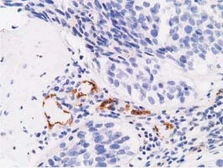 Anti-Alpha fetoprotein / AFP antibody [1E8] used in IHC (Paraffin sections) (IHC-P). GTX84953