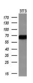 Anti-Alpha fetoprotein / AFP antibody [2A9] used in Western Blot (WB). GTX84954