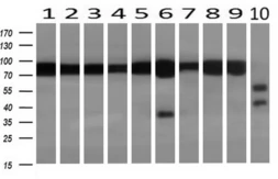 Anti-Aconitase 2 antibody [3G8] used in Western Blot (WB). GTX84963