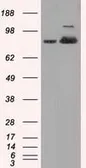 Anti-Aconitase 2 antibody [7G4] used in Western Blot (WB). GTX84965