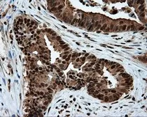 Anti-ATP citrate lyase antibody [3G8] used in IHC (Paraffin sections) (IHC-P). GTX84967