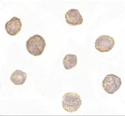Anti-Bim antibody [1C2H4] used in Immunocytochemistry/ Immunofluorescence (ICC/IF). GTX84980