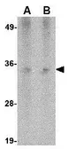 Anti-Hax1a antibody [9G6C6] used in Western Blot (WB). GTX84982