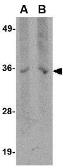 Anti-Hax1a antibody [9G3D11] used in Western Blot (WB). GTX84983