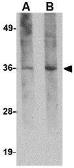 Anti-Hax1a antibody [8F9G7] used in Western Blot (WB). GTX84984