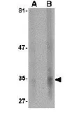 Anti-EndoG antibody [7F2G10] used in Western Blot (WB). GTX84985