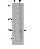 Anti-EndoG antibody [7F2D7] used in Western Blot (WB). GTX84986