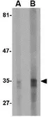 Anti-EndoG antibody [7G1G10] used in Western Blot (WB). GTX84987