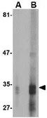 Anti-EndoG antibody [7G1C10] used in Western Blot (WB). GTX84988