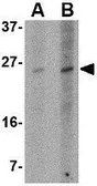 Anti-PUMA antibody [10D4G7] used in Western Blot (WB). GTX84989