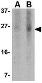 Anti-PUMA antibody [2A9G5] used in Western Blot (WB). GTX84991
