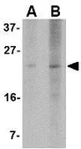 Anti-PUMA antibody [2A8F6] used in Western Blot (WB). GTX84992