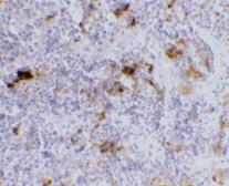 Anti-DC-SIGN antibody [8B6] used in IHC (Paraffin sections) (IHC-P). GTX84993
