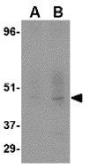 Anti-DC-SIGN antibody [5D7] used in Western Blot (WB). GTX84994