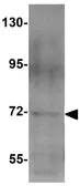 Anti-TMEM16A antibody used in Western Blot (WB). GTX85012
