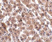 Anti-HAAO antibody used in IHC (Paraffin sections) (IHC-P). GTX85015