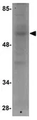 Anti-RNF168 antibody used in Western Blot (WB). GTX85018