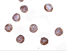 Anti-RNAse H2A antibody used in Immunocytochemistry/ Immunofluorescence (ICC/IF). GTX85020