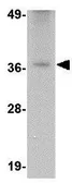 Anti-TREX2 antibody used in Western Blot (WB). GTX85021