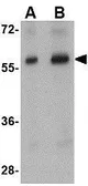 Anti-STK39 antibody used in Western Blot (WB). GTX85023