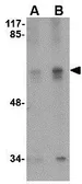 Anti-STK39 antibody used in Western Blot (WB). GTX85024