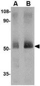 Anti-SPRED2 antibody used in Western Blot (WB). GTX85025