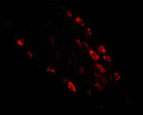 Anti-MEX3D antibody used in IHC (Paraffin sections) (IHC-P). GTX85026