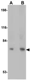 Anti-URP2 antibody used in Western Blot (WB). GTX85027