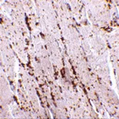 Anti-LIMP II antibody used in IHC (Paraffin sections) (IHC-P). GTX85033