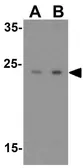 Anti-IRGM antibody used in Western Blot (WB). GTX85038