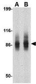 Anti-SP110 antibody used in Western Blot (WB). GTX85041