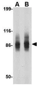 Anti-SP110 antibody used in Western Blot (WB). GTX85041