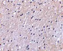 Anti-NHE-1 antibody used in IHC (Paraffin sections) (IHC-P). GTX85046