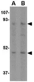 Anti-NHE-1 antibody used in Western Blot (WB). GTX85047