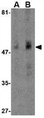 Anti-Carabin antibody used in Western Blot (WB). GTX85049