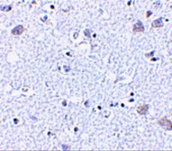 Anti-BRSK1 antibody used in IHC (Paraffin sections) (IHC-P). GTX85054