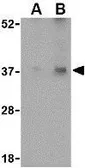 Anti-Emerin antibody used in Western Blot (WB). GTX85058