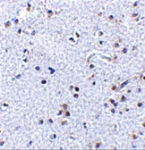 Anti-TSLP antibody used in IHC (Paraffin sections) (IHC-P). GTX85060